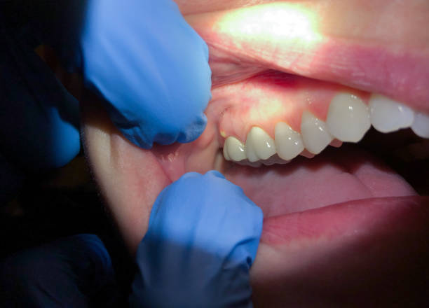 Best Pediatric Emergency Dentist in Elkhart Lake, WI